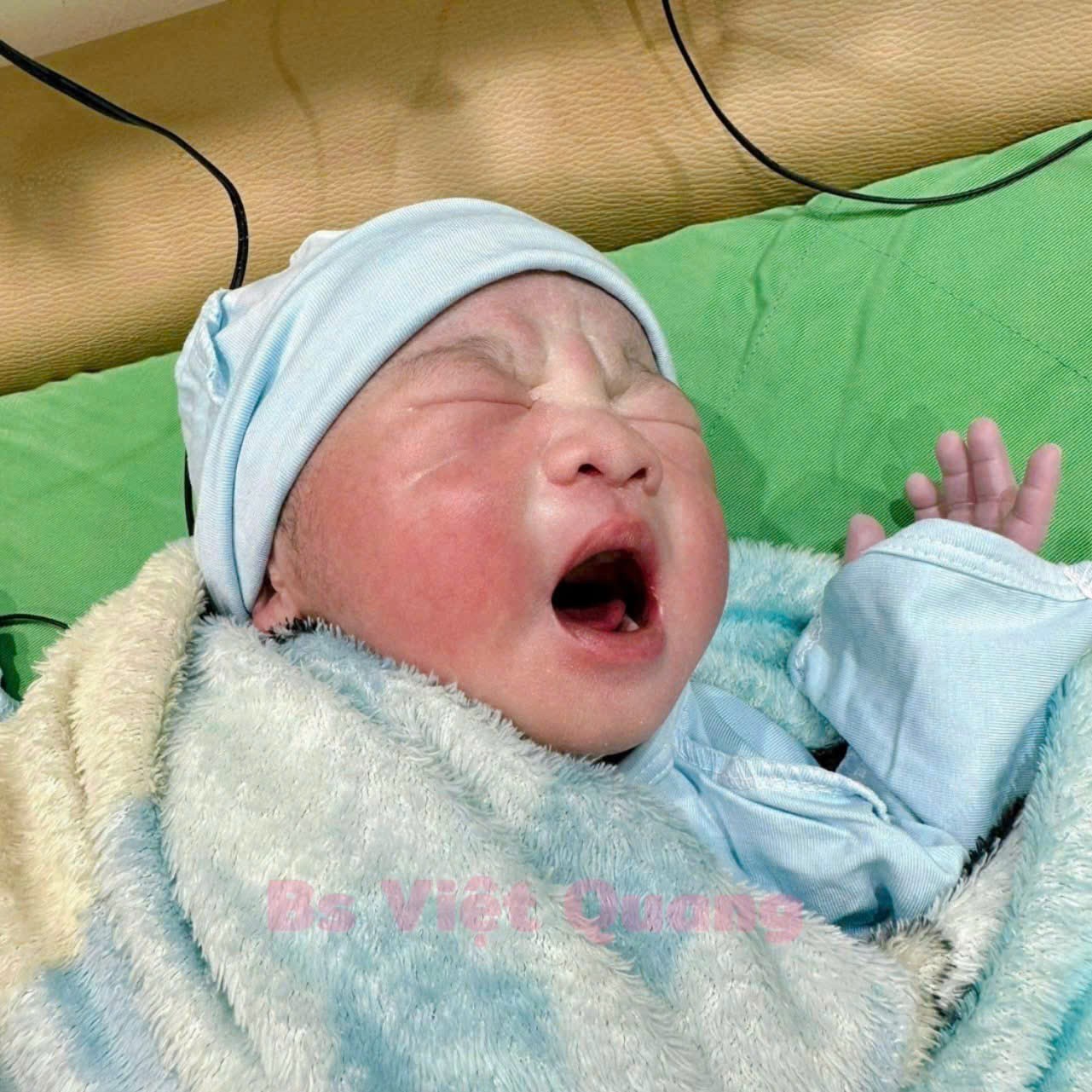 Em bé IVF