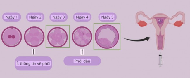 Quá trình thực hiện chu kỳ thụ tinh trong ống nghiệm mà người bệnh cần lưu ý. Quá trình thực hiện chu kỳ thụ tinh trong ống nghiệm mà người bệnh cần lưu ý.